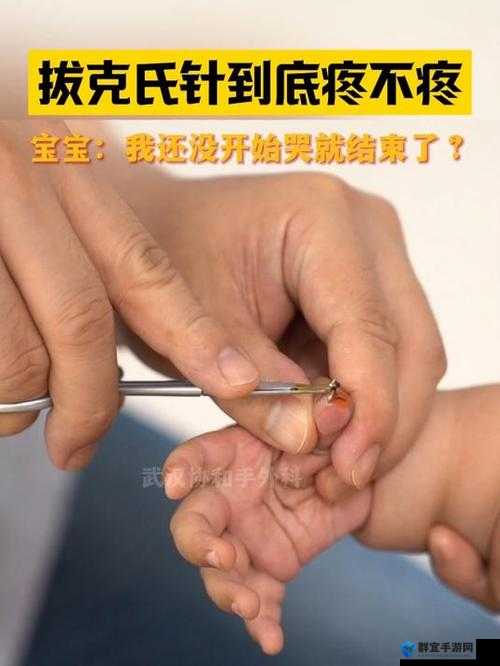 宝宝怎么才三根手指就痛：这到底是怎么回事呢