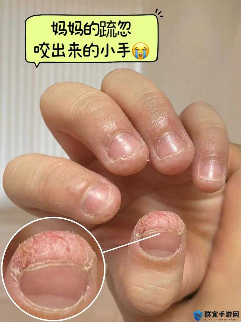 为什么手指划入缝隙挖水：探秘手指划入缝隙的神奇现象