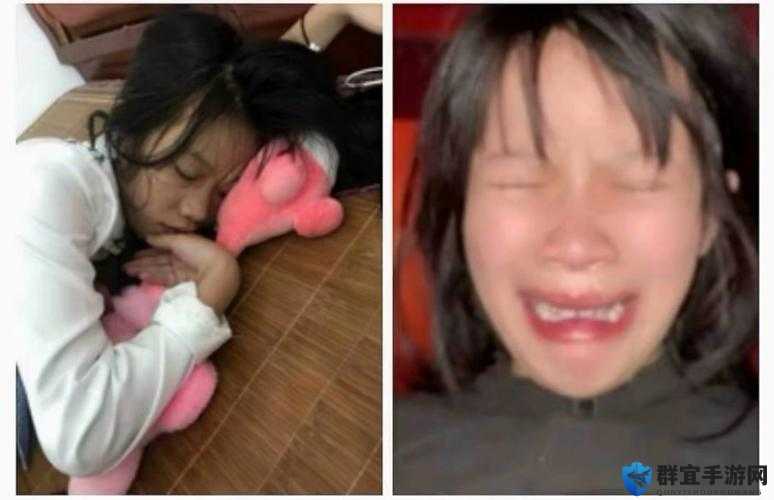 表妹出现红肿疼痛小缝不能合拢小孩的情况，这究竟是怎么回事？该如何应对？