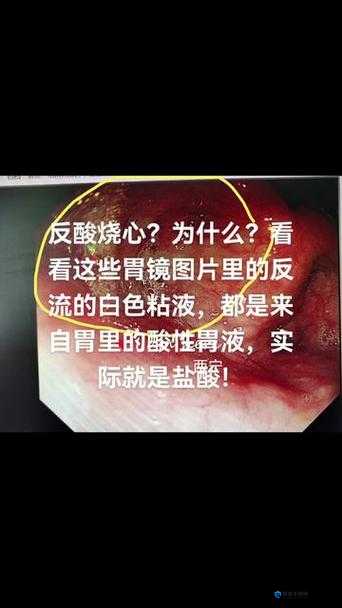 女生看视频流粘液所需时间变短的原因及影响因素分析，如何有效减少观看时间？