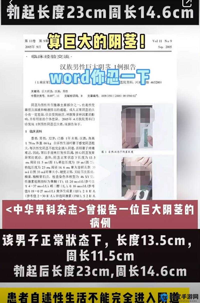 震惊男人生殖长35cm图片引发热议，网友纷纷惊叹不已，真相究竟如何？