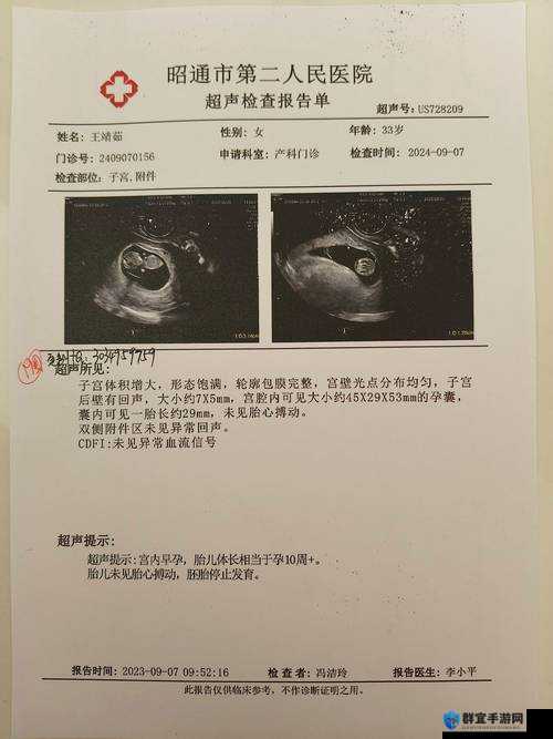 为何B超把男宝照成女宝？揭秘B超性别鉴定误差的常见原因与应对方法