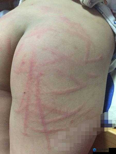趴好屁股从白打到红全过程揭秘：详细步骤与效果解析，让你轻松掌握技巧